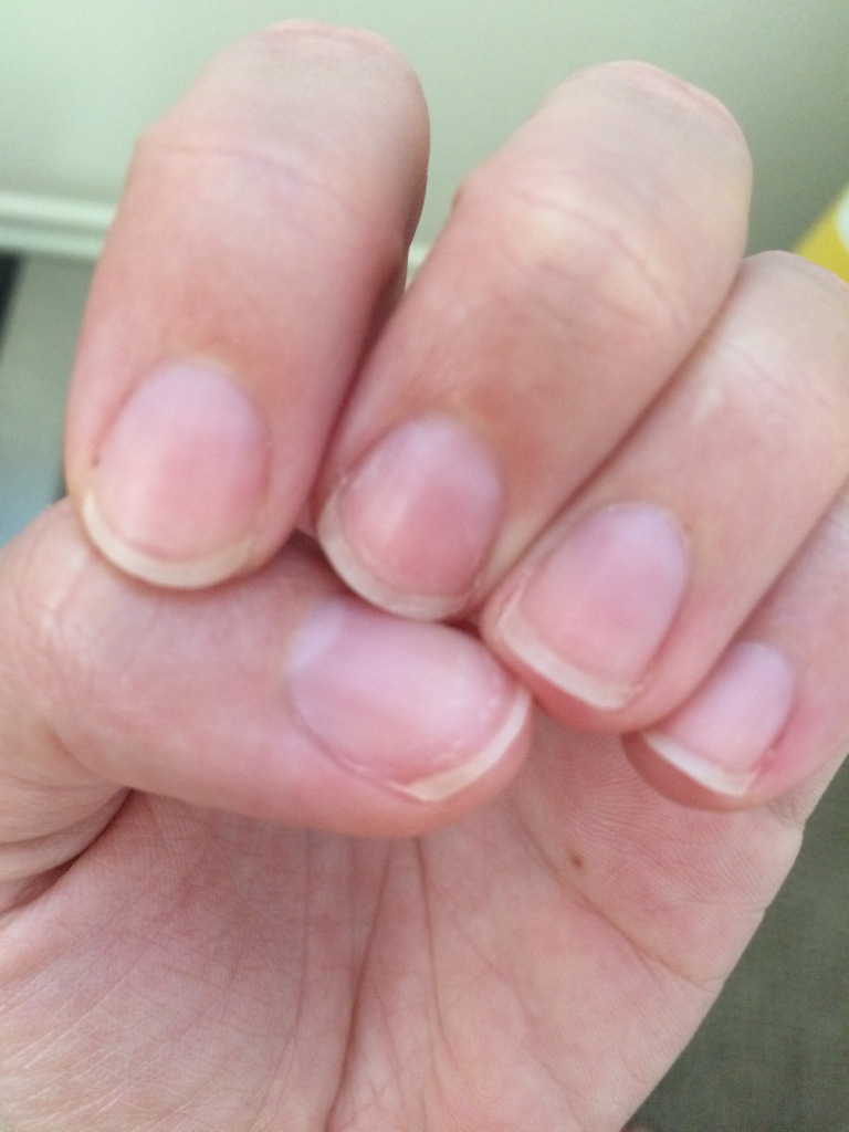 nail health